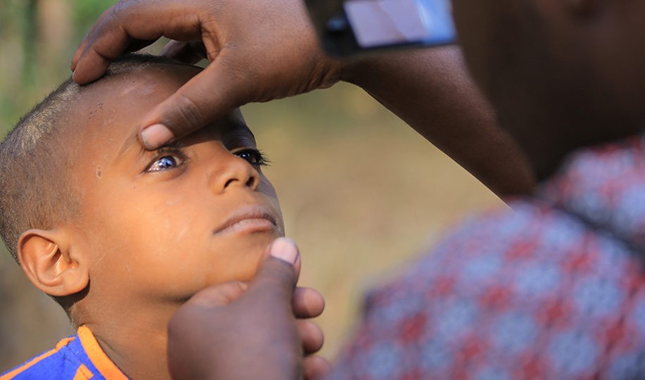 Unsere Mitgliedsorganisation Menschen für Menschen bekämpft die Augenkrankheit Trachom in Äthiopien. Foto: Menschen für Menschen